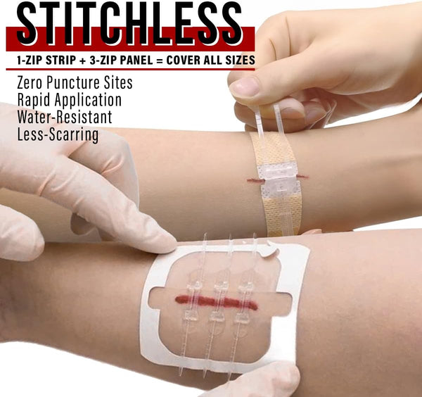 EVERLIT Wound Closure Kit vs Butterfly Bandages: Which Is Better? 🤔