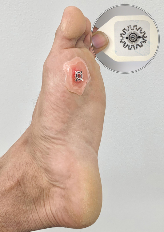 New Water-Powerd Electric Bandage Speeds Up Wound Healing by 30%