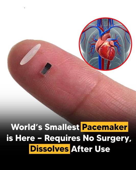 World's Smallest Pacemaker: A Game-Changer for Newborn Heart Care