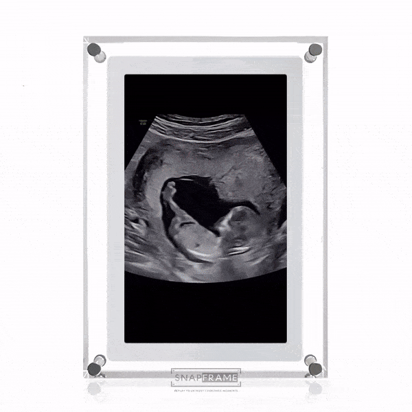 Preserve Your Baby’s Most Precious Moments—From the First Heartbeat to Tiny Fingers and Early Glimpses